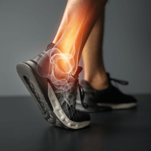 Exercises to Reduce Chronic Ankle Pain & Increase Ankle Stability